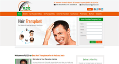 Desktop Screenshot of hairtransplantindia.net