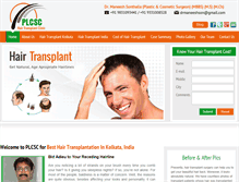 Tablet Screenshot of hairtransplantindia.net